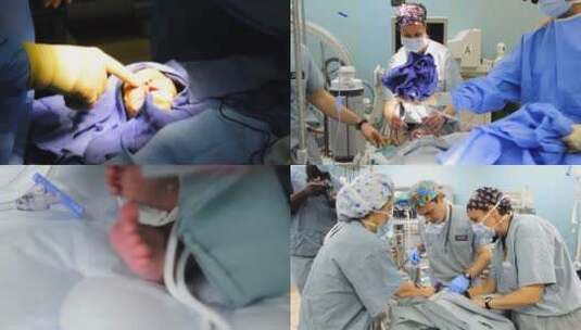 婴儿在陆军医院接受腭裂手术高清在线视频素材下载