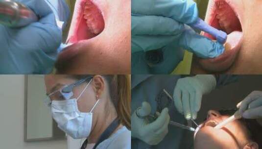 牙医为病人治疗牙齿高清在线视频素材下载