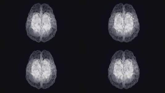 医学 大脑 脑科学 三维 脑ct1 模型高清在线视频素材下载