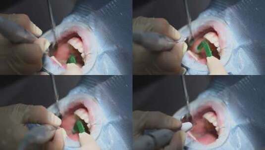 一名牙医在例行牙科检查中为一名妇女刷牙高清在线视频素材下载