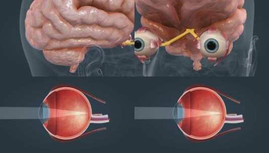 眼睛人眼神经医学三维动画高清在线视频素材下载