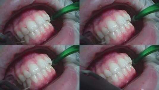 一名牙医在例行牙科检查中为一名妇女刷牙高清在线视频素材下载
