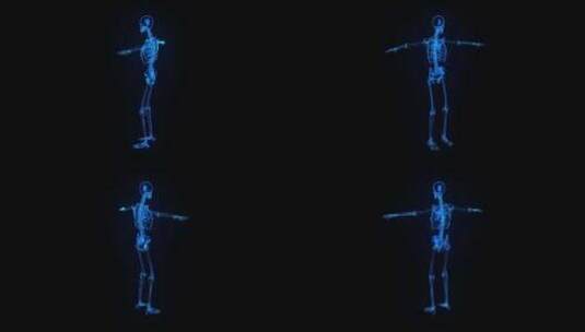 3D全息投影医疗科技医疗影像人体骨架骨骼高清在线视频素材下载