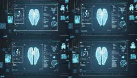 医学检测X光照片高清在线视频素材下载