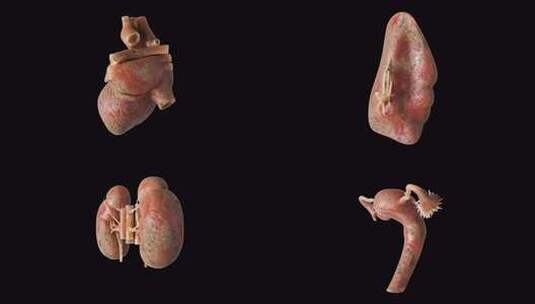 病变癌变的人体内脏器官高清在线视频素材下载