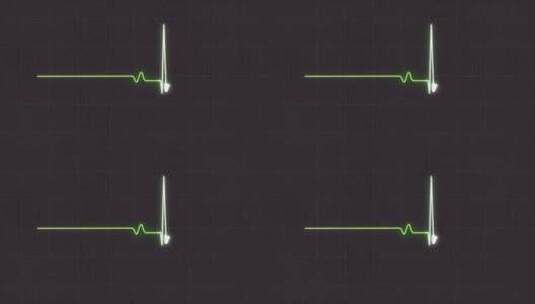 抽象心电图监视器在灰色背景上显示心跳高清在线视频素材下载