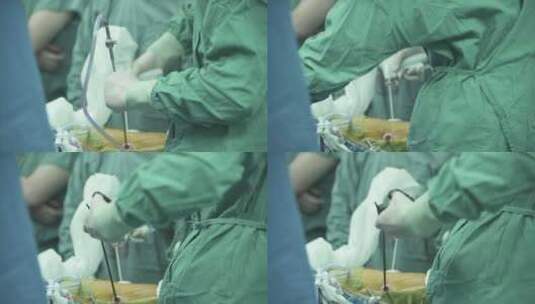 腔镜手术 手术室 医生 患者 手术器械高清在线视频素材下载