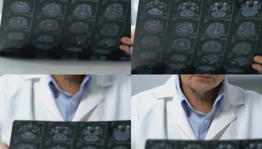 医生手拿影像片分析脑断层MIR摇头无法治愈高清在线视频素材下载