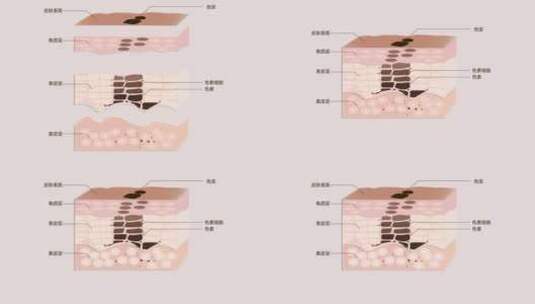 色素型皮肤分层和组合动画高清在线视频素材下载
