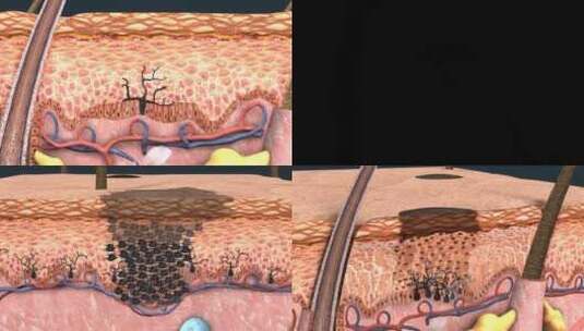 皮肤的层次皮肤冷热感觉 皮神经 三维动画高清在线视频素材下载