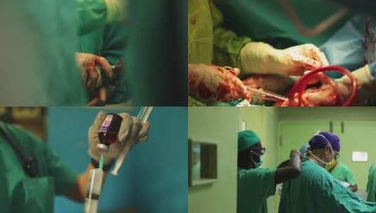 医生给病人做手术高清在线视频素材下载