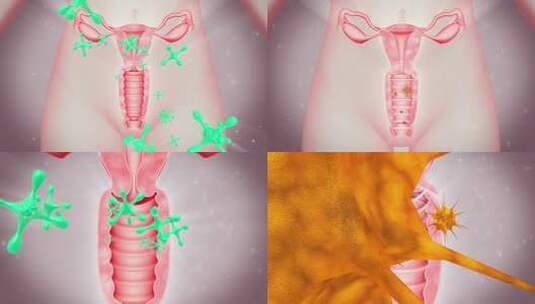 引导分泌物 子宫 卵巢高清在线视频素材下载