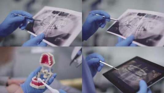 看牙，牙科，医疗器械 x光片高清在线视频素材下载