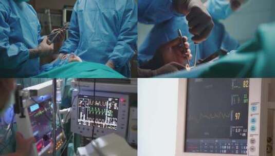 医生手术过程高清在线视频素材下载