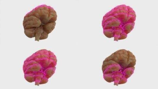 大脑、扫描、激光、科学高清在线视频素材下载