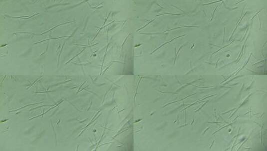 显微镜下的大量细菌 放大400倍高清在线视频素材下载