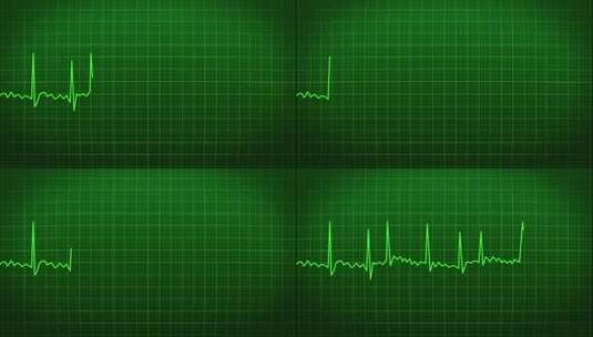 绿色心电图线条素材高清在线视频素材下载