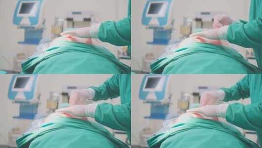 医生为患者进行手术的医疗场景高清在线视频素材下载