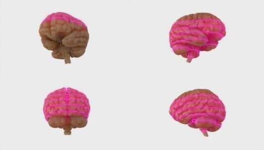 大脑、扫描、激光、科学高清在线视频素材下载