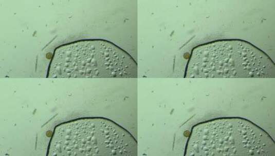 显微镜下的大量细菌与硅藻 放大100倍 2高清在线视频素材下载