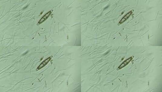 显微镜下的大量细菌与硅藻 放大400倍高清在线视频素材下载