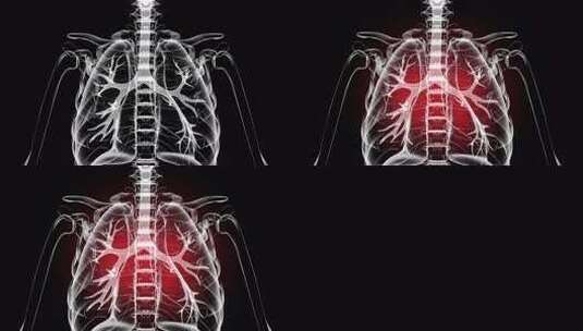 肺部疾病。人类肺部炎症。黑色背景上的人的高清在线视频素材下载