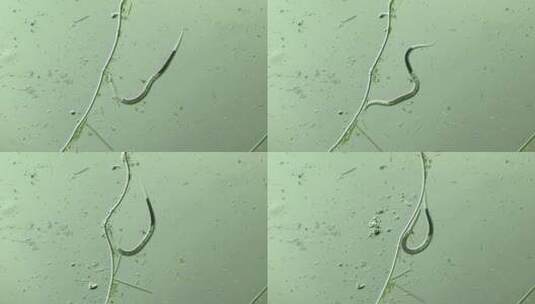 显微镜下的线虫 放大100倍高清在线视频素材下载