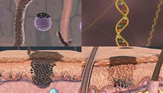 日光浴皮肤癌黑色素医学三维动画高清在线视频素材下载