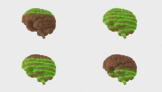 大脑、扫描、激光、科学高清在线视频素材下载