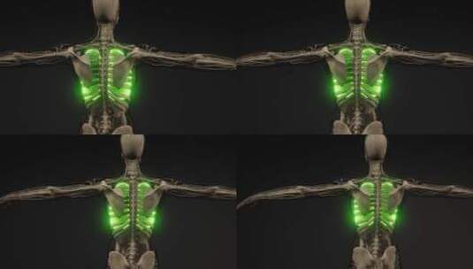人肺放射学检查高清在线视频素材下载