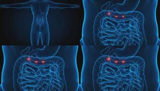 人类消化系统高清在线视频素材下载