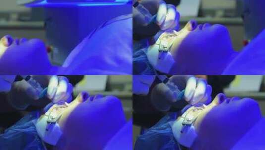 一名患者接受激光眼科手术高清在线视频素材下载