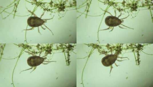 显微镜下的蜱虫2高清在线视频素材下载