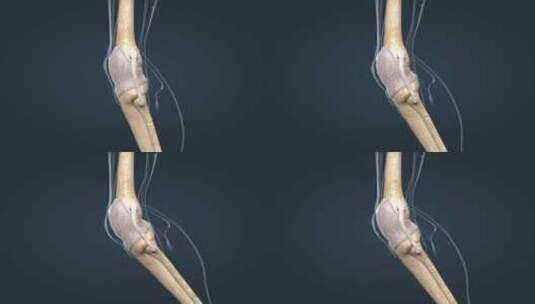 关节囊韧带骨连接关节炎积液病变医学动画高清在线视频素材下载