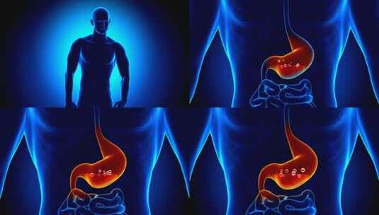 胃痛-胃酸动画胃胀胃病胃癌胃酸胃炎高清在线视频素材下载