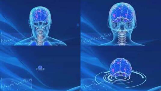 受感染大脑的3d渲染医学动画高清在线视频素材下载