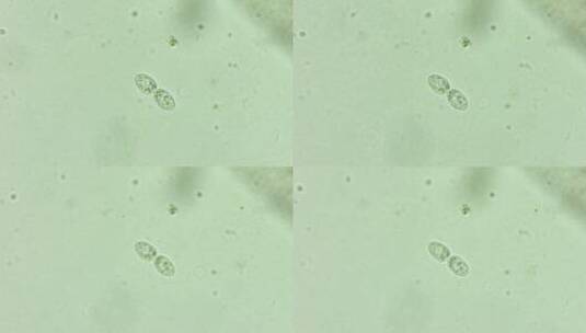 微生物纤毛虫细菌单细胞原生生物 3高清在线视频素材下载