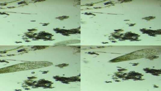 微分干涉DIC显微镜放大100倍的微生物喇叭虫细胞3高清在线视频素材下载