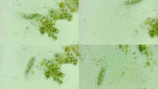 微生物纤毛虫细菌单细胞原生生物高清在线视频素材下载