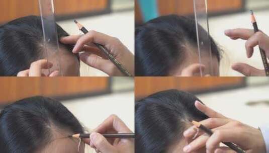 一女子去植发 植发手术高清在线视频素材下载