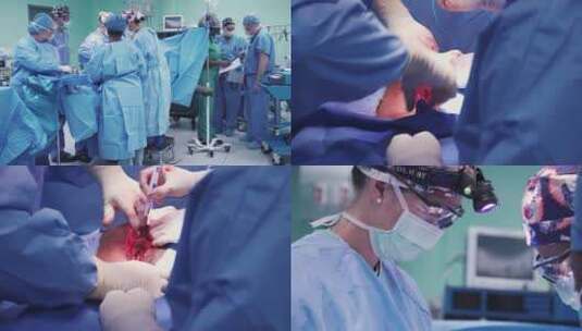 进行子宫切除手术高清在线视频素材下载