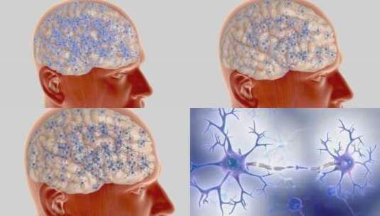 脑血栓 脑神经  大脑神经 脑细胞大脑高清在线视频素材下载
