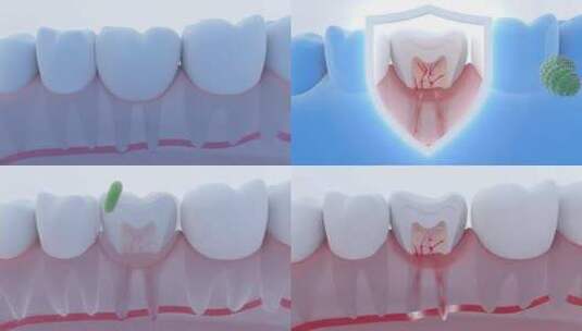 牙齿清洁 护牙 口腔洁白 牙垢清理高清在线视频素材下载