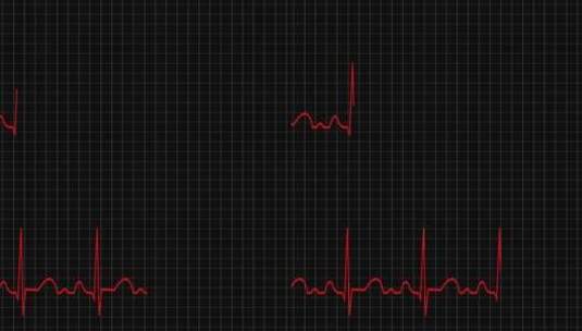 心电图 心脏跳动高清AE视频素材下载