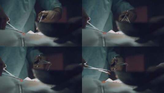 外科缝合手术特写高清在线视频素材下载