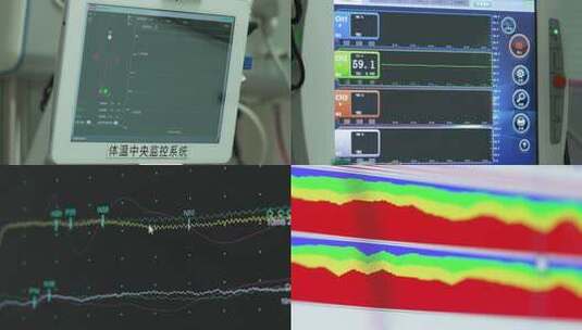 实拍医院医疗设备仪器心电图监护高清在线视频素材下载