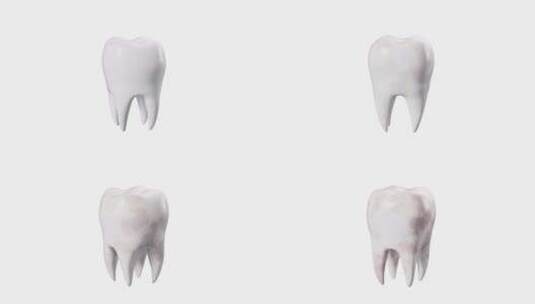 带透明通道的牙齿牙菌斑牙结石牙垢视频高清在线视频素材下载