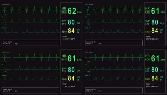 循环：患者监护仪显示生命体征心电图心电图高清在线视频素材下载