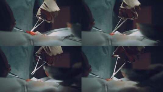 做手术的外科医生高清在线视频素材下载
