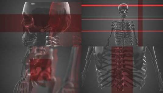快速骨骼故障性logo展示片场AE模板高清AE视频素材下载